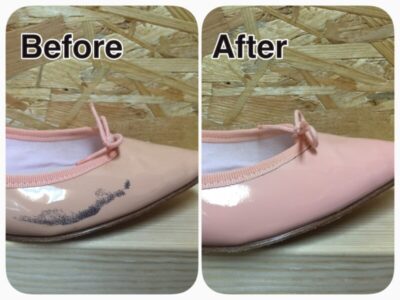 エナメル黒ずみ修理1