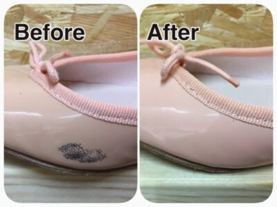 エナメル黒ずみ修理2