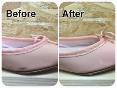 エナメル黒ずみ修理3